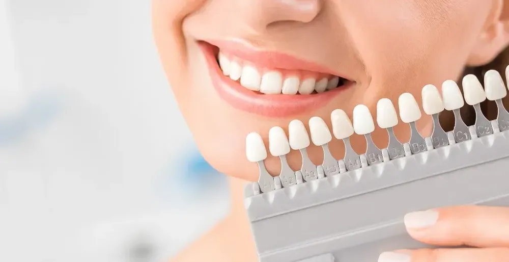 dental crowns wa