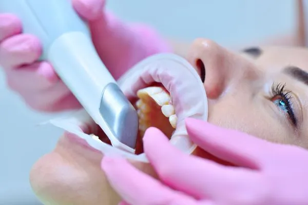 intraoral scan