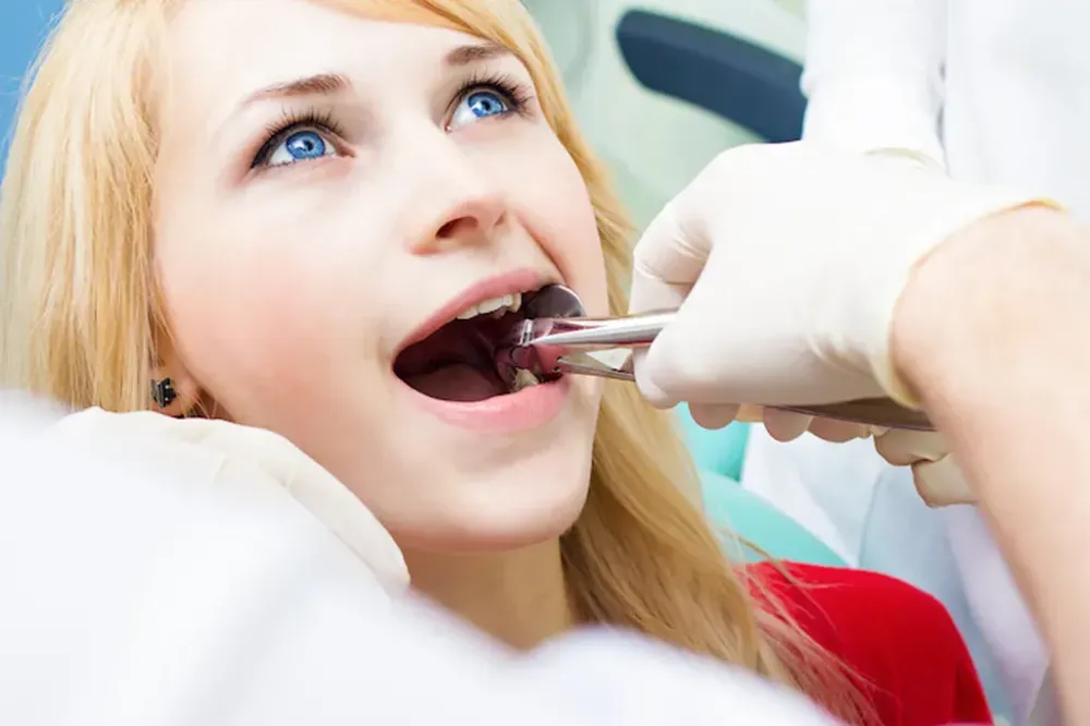 tooth extraction myths