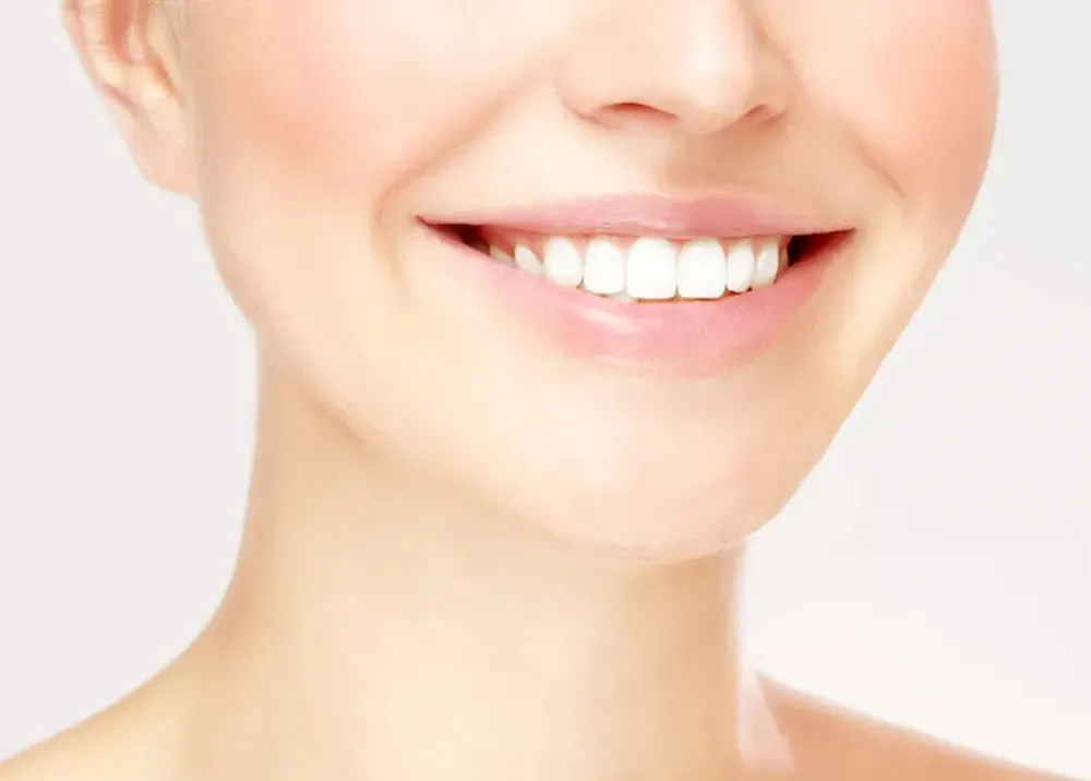 veneers problems 1